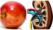 Healthy Kidneys: కిడ్నీలు ఆరోగ్యంగా ఉండాలంటే ఈ 5 అప్పుడప్పుడూ తింటూ ఉండండి.. రాళ్ల సమస్య కూడా రాదు..