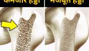 Calcium Rich Foods: ఎముకలు గుల్లగా ఉండి ఆస్టియోపోరోసిస్ సమస్య ఉందా..ఈ 5 ఫుడ్స్ తీసుకుంటే చాలు