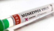 Monkeypox in India: ఇండియాలో మంకీపాక్స్ కలవరం, లక్షణాలు, చికిత్స, టెస్ట్ ఎలా ఉంటాయి