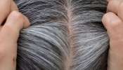 White Hair: పెరుగుతో ఈ ప్యాక్‌ ట్రై చేయండి.. తెల్ల వెంట్రుకలు జీవితంలో మళ్లీ రావు