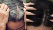 White Hair Remedies: డైట్ ఇలా మార్చితే తెల్ల జుట్టు శాశ్వతంగా నల్లబడటం ఖాయం ఆ విటమిన్ లోపమే కారణం