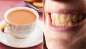 Healthy Teeth Tips: పళ్లు అందంగా, ఆరోగ్యంగా మిళమిళలాడాలంటే ఈ అలవాట్లు మానేయాలి