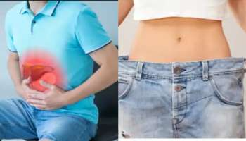 Fatty Liver: ఐటీ ఉద్యోగులను పీడిస్తున్న ఫ్యాటీ లివర్‌.. ఈ 5 అలవాట్లతో లివర్‌ పూర్తిగా క్లీన్‌..!