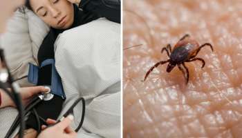 Scrub typhus: ఆంధ్ర ప్రజలను భయపెడుతున్న స్క్రబ్ టైఫస్.. వచ్చే లక్షణాలు, తీసుకోవలసిన జాగ్రత్తలు ఇవే..!