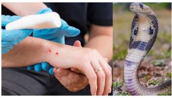 Snake Bite: పాముకాటు వేసిన వెంటనే నెయ్యితో ఈ పొడిని కలిపి రుద్దండి.. విషం వ్యాపించదు! 