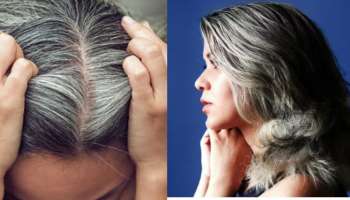 White hairs: తెల్లజుట్టు వారికి పండగ లాంటి వార్త.!. సంచలన విషయాలు బైటపెట్టిన జపాన్ శాస్త్రవేత్తలు.. మ్యాటర్ ఏంటంటే..?