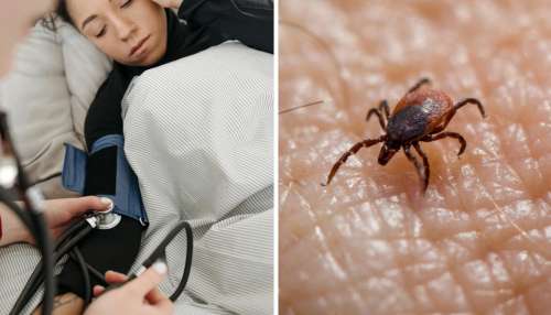 Scrub typhus: ఆంధ్ర ప్రజలను భయపెడుతున్న స్క్రబ్ టైఫస్.. వచ్చే లక్షణాలు, తీసుకోవలసిన జాగ్రత్తలు ఇవే..!