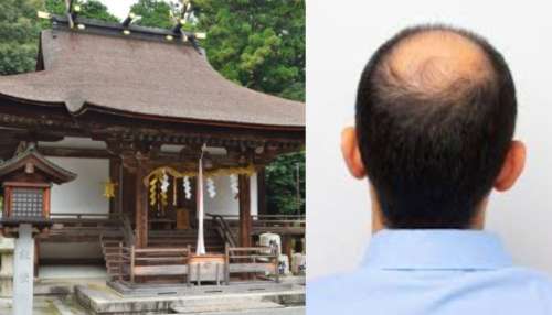 Viral News: ఇదెక్కడి విడ్డూరం... ఆ ఆలయానికి వెళ్తే బట్టతల మీద జుట్టు వస్తుందంట.. అసలు మ్యాటర్ ఏంటంటే..?