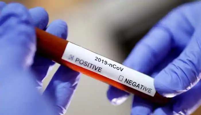 CoronaVirus: అమెరికాలో 40 లక్షలకు చేరిన కరోనా బాధితులు