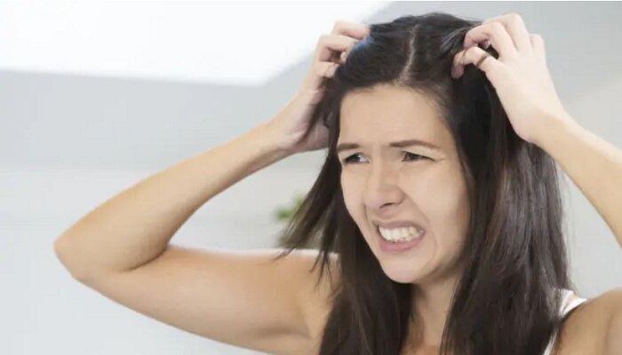 Hair fall control, Dandruff: జుట్టు రాలడం: చుండ్రు వల్ల జుట్టు రాలుతుందా ?