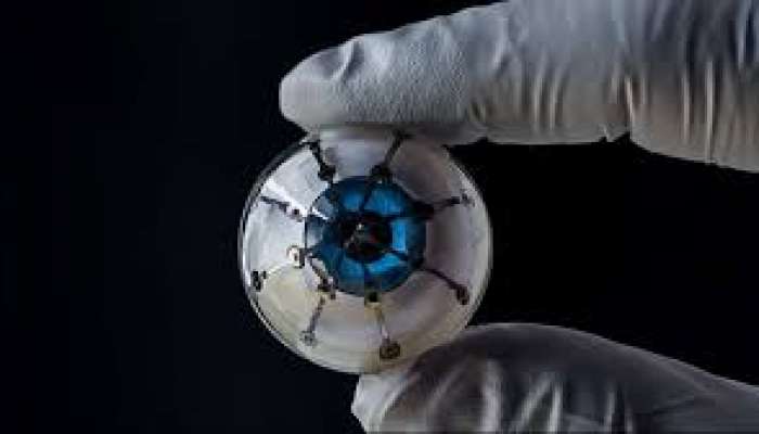 Bionic Eye: ప్రపంచంలోనే తొలిసారిగా..కంటిచూపు తిరిగి తెచ్చే ప్రయోగం