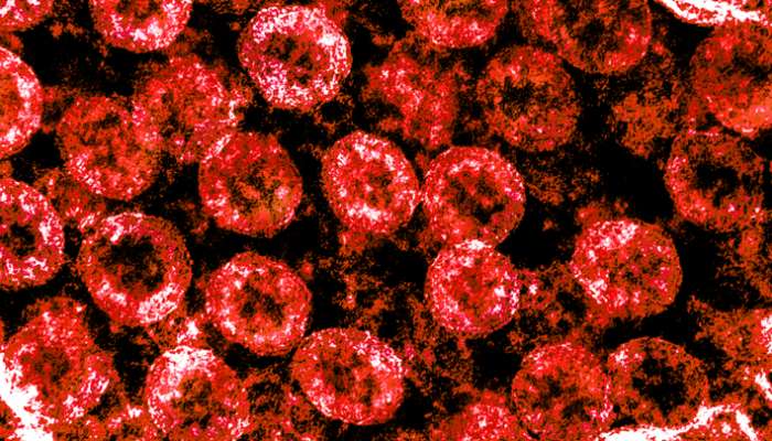 Coronavirus: మీ బ్లడ్ గ్రూపును బట్టి మీ పై కరోనా ప్రభావం గురించి తెలుసుకోవడమెలా