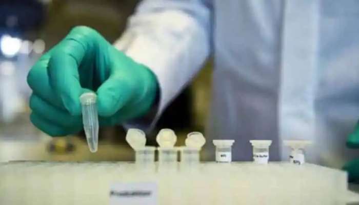 AstraZeneca వ్యాక్సిన్ తీసుకున్న వాలంటీర్ మృతి AstraZeneca వ్యాక్సిన్ తీసుకున్న వాలంటీర్ మృతి