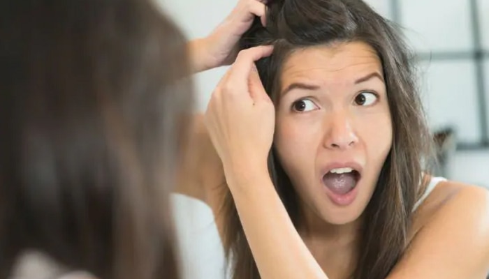 Healthy Hair Tips: జుట్టు రాలడం తగ్గాలంటే.. ఈ చిట్కాలు పాటించండి!