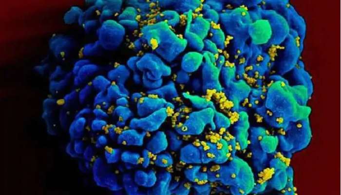 Monkeypox Virus: అమెరికాలో 20 ఏళ్ల తరువాత మళ్లీ మంకీపాక్స్ వైరస్, టెక్సాస్‌లో తొలికేసు