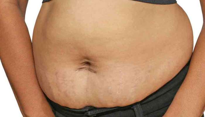 Weight Loss Food for Post Pregnancy: ప్రెగ్నన్సీ తరువాత శరీర బరువు తగ్గించే ఆహారాలు 