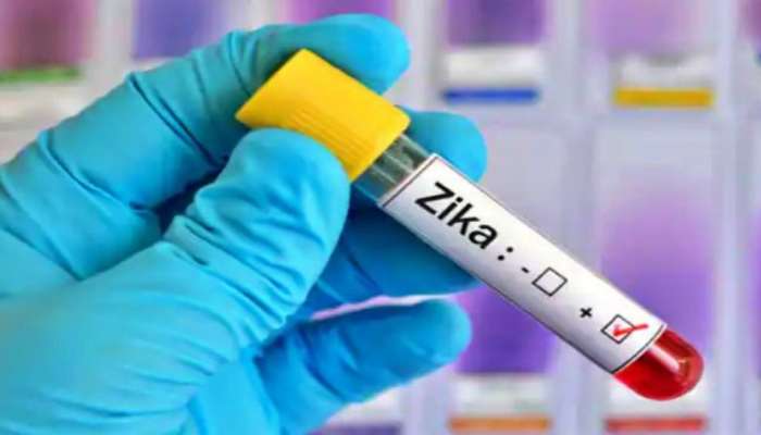 Zika Virus: ఉత్తరప్రదేశ్‌లో తొలి జికా వైరస్ కేసు.. ఐఏ‌ఎఫ్ ఆఫీసర్‌కు పాజిటివ్‌!