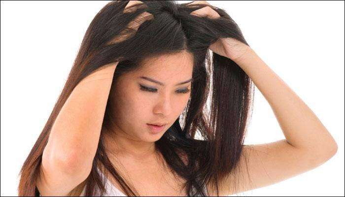 Best home remedies to check or remove dandruff in hair, here are the tips | Dandruff: ఏం చేసినా జుట్టులో చుండ్రు పోవడం లేదా? ఇలా ట్రై చేస్తే చుండ్రు మాయమైపోతుంది| హెల్త్ News in Telugu Best home remedies to check or remove dandruff in hair, here are the tips | Dandruff: ఏం చేసినా జుట్టులో చుండ్రు పోవడం లేదా? ఇలా ట్రై చేస్తే చుండ్రు మాయమైపోతుంది| హెల్త్ News in Telugu