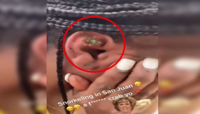 Viral Video: మహిళ చెవిలో ఇరుక్కున్న పీత.. ఇలాంటి వీడియో ఎప్పుడూ చూసుండరేమో