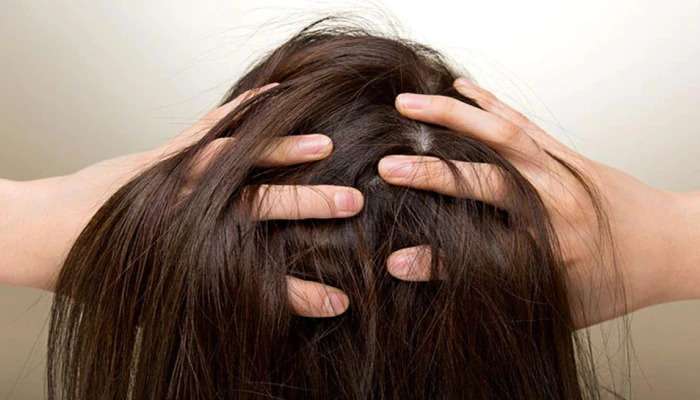 Hair Care Tips: జుట్టులోని రూట్స్ వద్ద అధిక నొప్పితో బాధపడుతున్నారా...! అయితే ఈ చిట్కా ఉపయోగించి ఉపశమనం పొందండి..!!