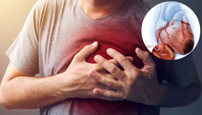 Heart Attack Symptoms: గుండెపోటు వచ్చే ముందు శరీరంలో ఈ 4 రకాల సమస్యలు వస్తాయి..!