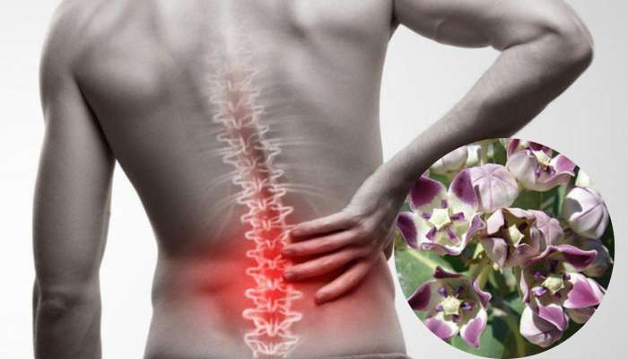 Back Pain Relief: ఈ మిశ్రమాన్ని ఒక్కసారి నొప్పిలు ఉన్న చోట పూస్తే చాలు.. నొప్పులు మటు మాయం..!!