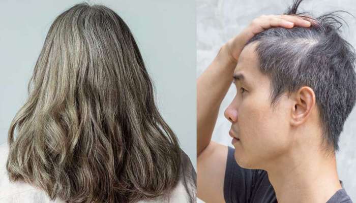 Rid Of White Hair Naturally: Get Rid White Hair Naturally With Gourd Juice Gourd Peel | Rid Of White Hair Naturally: తెల్ల జుట్టు సమస్యలతో బాధపడుతున్నారా.. అయితే ఇది మీ కోసమే News in Telugu Rid Of White Hair Naturally: Get Rid White Hair Naturally With Gourd Juice Gourd Peel | Rid Of White Hair Naturally: తెల్ల జుట్టు సమస్యలతో బాధపడుతున్నారా.. అయితే ఇది మీ కోసమే News in Telugu