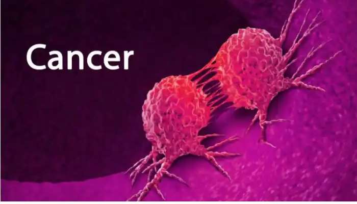 Mastalgia and Breast Cancer: మాస్టాల్జియా, రొమ్ము కేన్సర్ రెండూ ఒకటేనా, ఈ సమస్యకు కారణాలేంటి