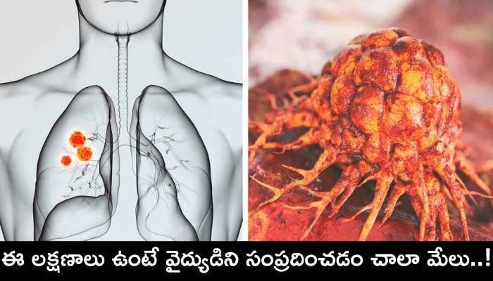 Cancer Symptoms In Telugu: ఈ లక్షణాలు ఉంటే వైద్యుడిని సంప్రదించడం చాలా మేలు.. లేకపోతే ఈ తీవ్రమైన కాన్సర్‌ ఎదుర్కొవాల్సిందే..!