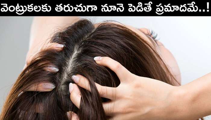 Disadvantages Of Oiling Hair: Applying Oil To The Hair Often Makes It Weak Hair And Causes Problems And Dandruff| Disadvantages Of Oiling Hair: తరుచుగా వెంట్రుకలు రాలుతున్నాయని నూనె పెడుతున్నారా ... Disadvantages Of Oiling Hair: Applying Oil To The Hair Often Makes It Weak Hair And Causes Problems And Dandruff| Disadvantages Of Oiling Hair: తరుచుగా వెంట్రుకలు రాలుతున్నాయని నూనె పెడుతున్నారా ...