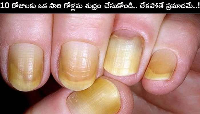 How To Clean Dirty Nails: గోళ్లు తరచుగా శుభ్రం చేసుకోకపోతే ఈ సమస్యలు తప్పవు..!