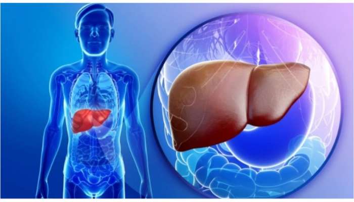 Healthy Liver Tips: లివర్ సమస్యకు మద్యపానం కారణం కాదు..ఈ 8 అలవాట్లు మానేయండి