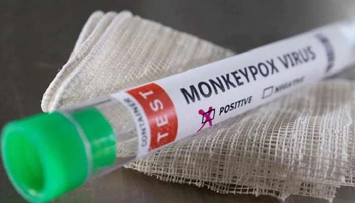 Monkeypox Test Kit: మంకీపాక్స్ నిర్ధారణలో మేకిన్ ఇండియా ఆర్టీపీసీఆర్ టెస్ట్ కిట్, 50 నిమిషాల్లోనే ఫలితాలు