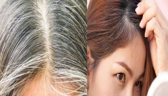 White Hair: తెల్లజుట్టు సమస్య నుంచి ఎలా ఉపశమనం, నేచురల్ పద్ధతులేమున్నాయి
