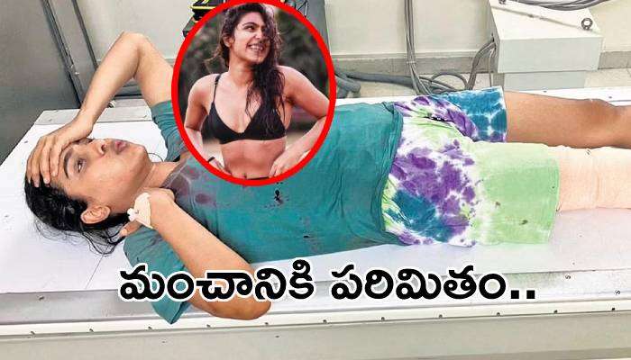 Samyuktha Hegde Injured: వివాదాస్పద హీరోయిన్ కు తీవ్ర గాయాలు.. ఏమైందంటే? 