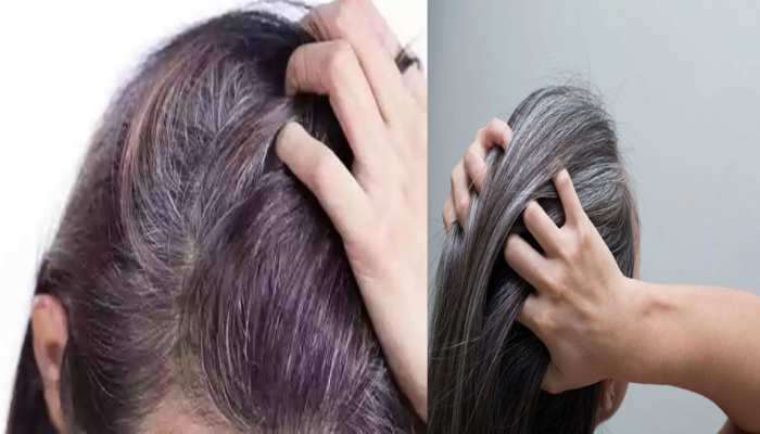 white hair remedies these three home remedies prevent white hair and helps grey hair turn black again | White Hair Remedies: ఈ 3 చిట్కాలతో తెల్ల జుట్టు సమస్యకు చెక్.. ఇంట్లోనే సులువుగా ... white hair remedies these three home remedies prevent white hair and helps grey hair turn black again | White Hair Remedies: ఈ 3 చిట్కాలతో తెల్ల జుట్టు సమస్యకు చెక్.. ఇంట్లోనే సులువుగా ...
