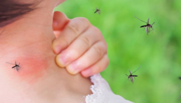 Mosquitoes Bite Reason: దోమలు కొందరినే ఎక్కువగా ఎందుకు కుడతాయో తెలుసా?