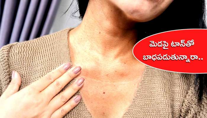 Neck Tan Remove: ఇలా చేస్తే చాలు కేవలం 4 రోజుల్లో మెడపై టాన్‌ శుభ్రమవుతుంది..