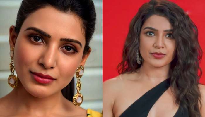 Samantha Face Surgery : సమంత మొహానికి ప్లాస్టిక్ సర్జరీ?.. ఆ ఫోటోలతోనే వార్తలు చక్కర్లు కొడుతున్నాయా?