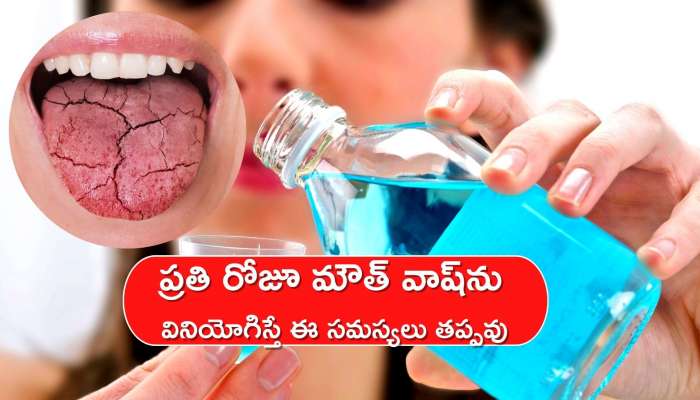 Mouthwash Side Effects: ప్రతి రోజూ మౌత్ వాష్‌ను వినియోగిస్తున్నారా.. అయితే ఈ తీవ్ర సమస్యలు తప్పవు..