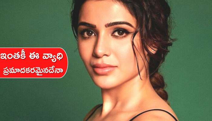  Samantha: సమంతకు మయోసైటిస్ రావడాని కారణాలు ఇవేనా.. ఇంతకీ ఈ వ్యాధి ప్రమాదకరమైనదేనా..