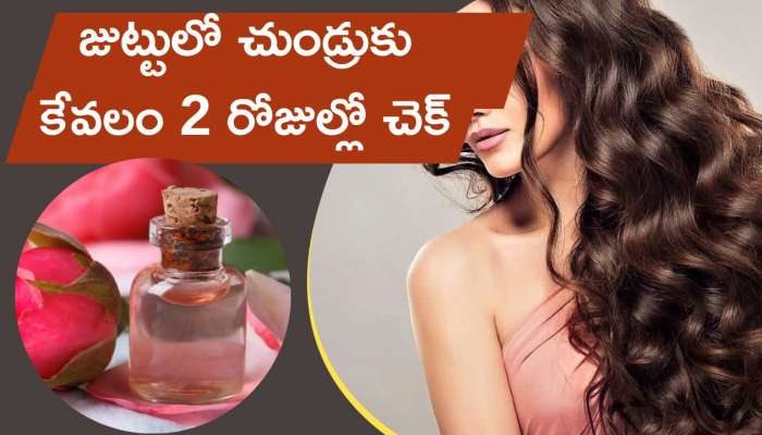 Rose water uses in Winter: Applying Rose Water On Hair Can Reduce Dandruff And Hair Loss In Just 2 Days | Silky Hair Tips: చలి కాలం వచ్చే జుట్టులో చుండ్రుకు కేవలం 2 రోజుల్లో Rose water uses in Winter: Applying Rose Water On Hair Can Reduce Dandruff And Hair Loss In Just 2 Days | Silky Hair Tips: చలి కాలం వచ్చే జుట్టులో చుండ్రుకు కేవలం 2 రోజుల్లో