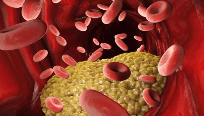 Cholesterol Control Tips: మీకు కొలెస్ట్రాల్ ఉందా..అయితే ఈ 4 తప్పులు అస్సలు చేయవద్దు
