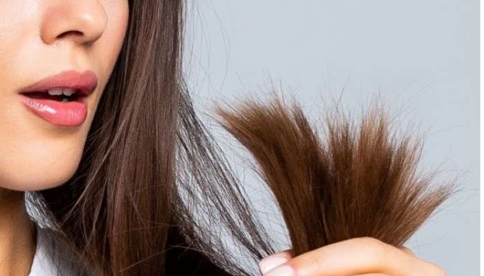 Hair Care Tips: అది రాస్తే చాలు.. డేండ్రఫ్, స్ప్లిట్ ఎండ్స్ నుంచి తక్షణం ఉపశమనం