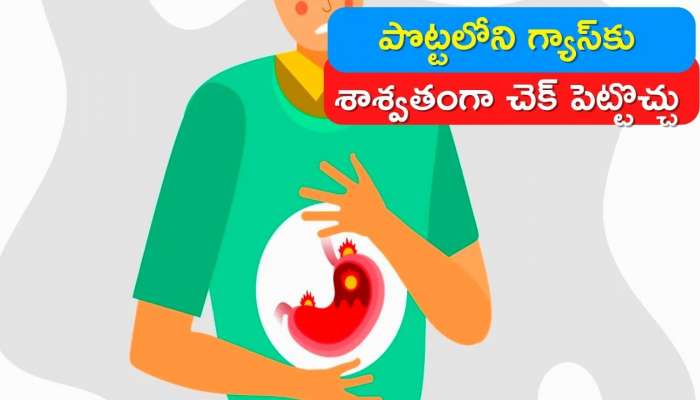 Gastritis Relief Tips: పొట్టలోని గ్యాస్‌కు ఈ చిట్కాలతో 5 నిమిషాల్లో శాశ్వతంగా చెక్‌ పెట్టొచ్చు..