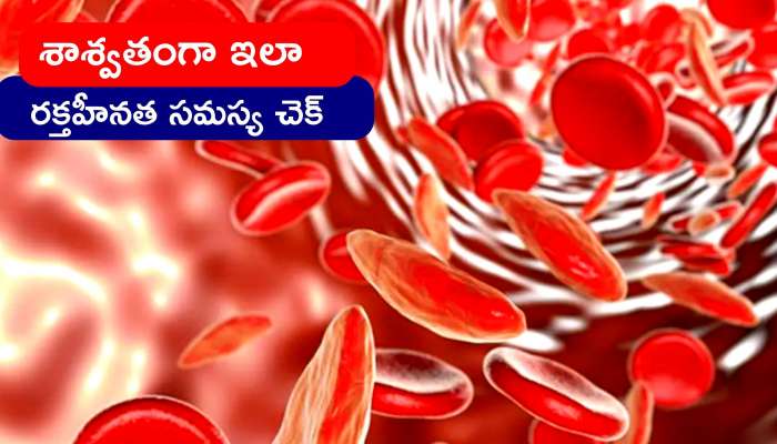 Anemia Disease: శాశ్వతంగా ఇలా రక్తహీనత సమస్య నుంచి ఉనపశమనం పొందవచ్చు..