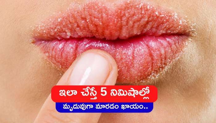 Rid Of Chapped Lips: పదే పదే పెదవులు పగులుతున్నాయా? ఇలా చేస్తే 5 నిమిషాల్లో మృదువుగా మారడం ఖాయం..