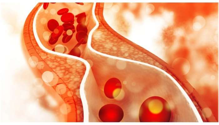 Cholesterol: చలికాలంలో పొరపాటున కూడా ఇవి తినొద్దు, కొలెస్ట్రాల్ వేగంగా పెరిగే ప్రమాదం