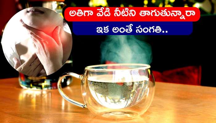 Warm water benefits: ఈ వ్యాధులన్నవారే గోరువెచ్చని నీటిని తాగాలి..అతిగా కూడా తాగొద్దు..  