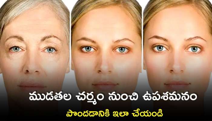 Vitamin C Deficiency: ముడతల చర్మం నుంచి గ్లోయింగ్‌ పొందాలనుకుంటున్నారా..ఇలా చేయండి..